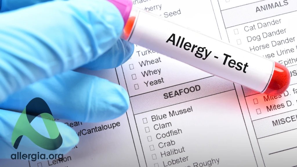 АСИТ — аллерген-специфическая иммунотерапия