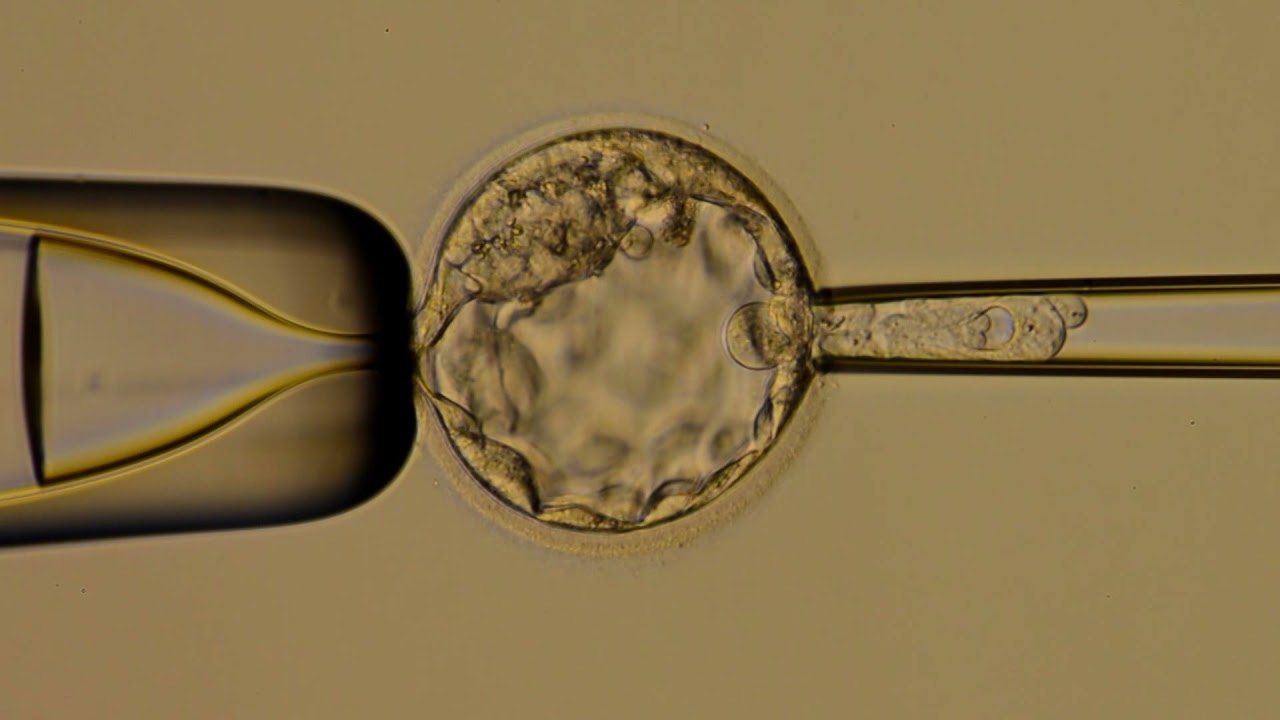 Лазерная система для биопсии трофэктодермы эмбриона