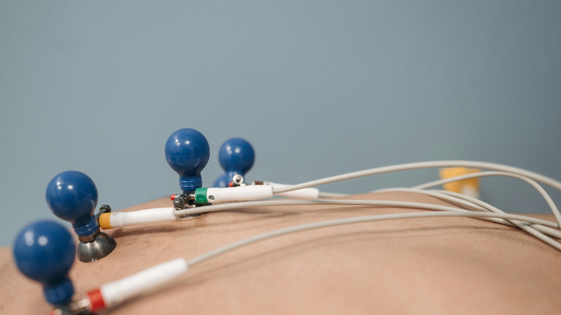 Как выбрать электрокардиограф