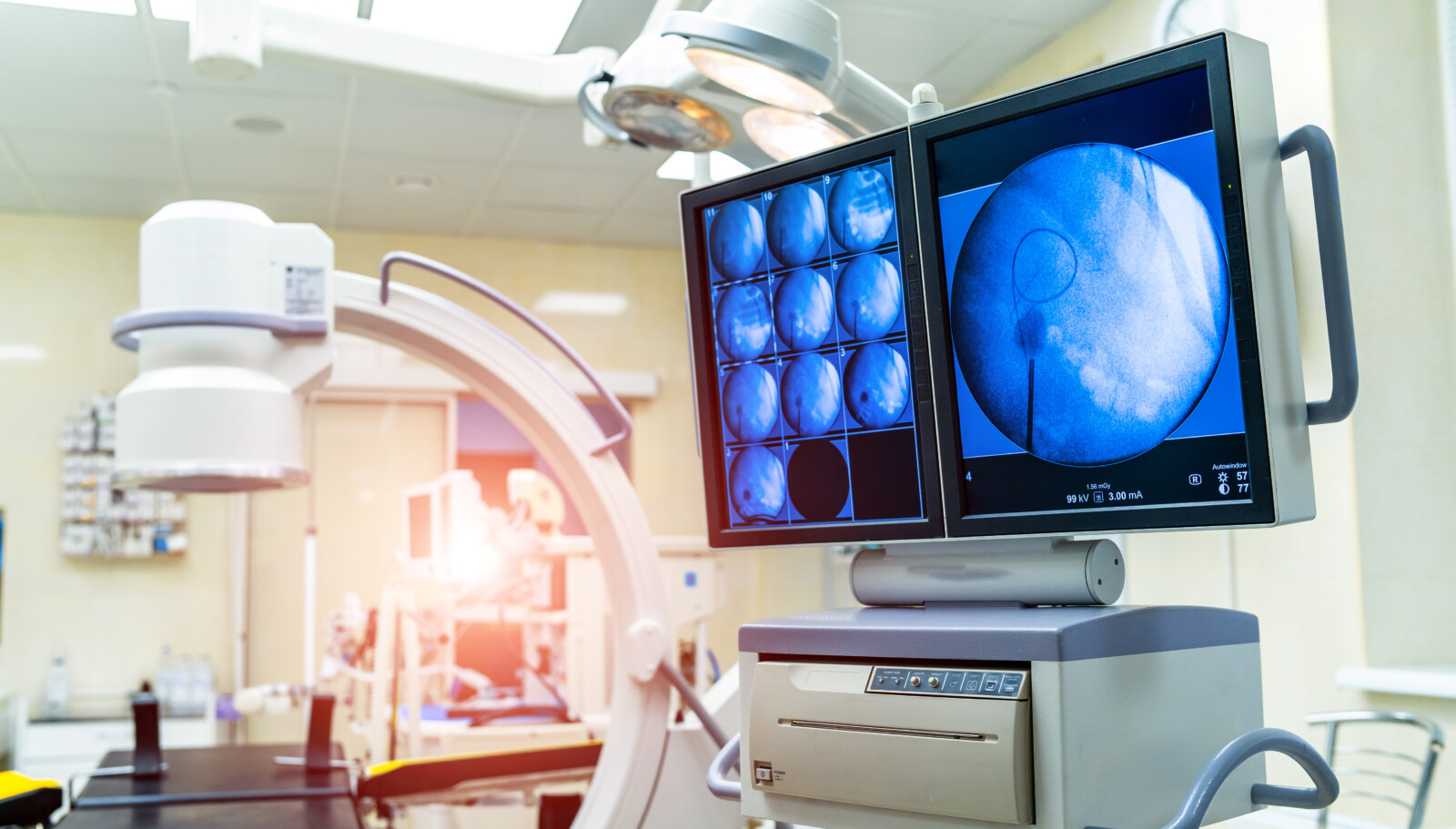 Как выбрать рентгеновский аппарат