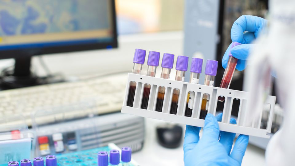 Жидкая биопсия: неинвазивная онкодиагностика по анализу крови