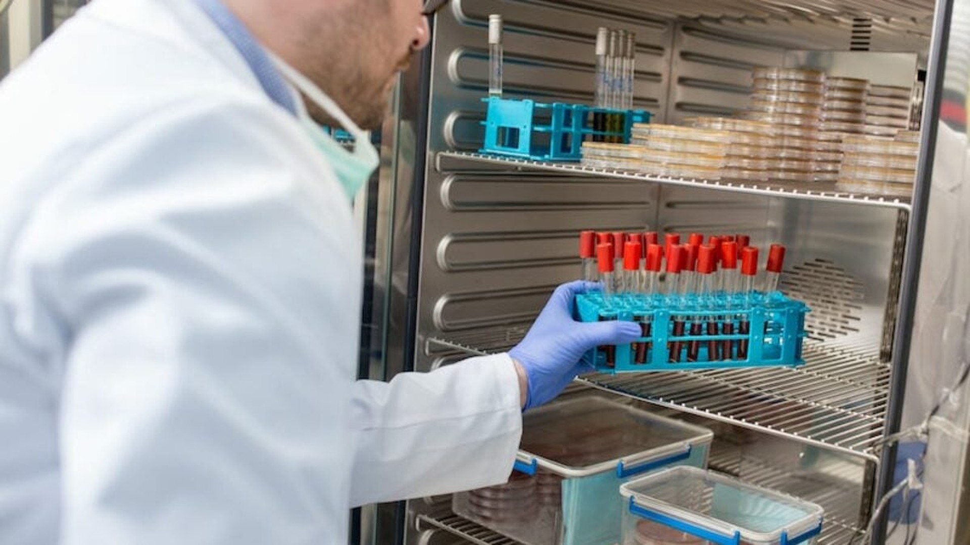 Особенности выбора медицинской морозильной камеры